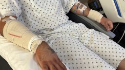 The man's injuries visible in this photo of him in the hospital